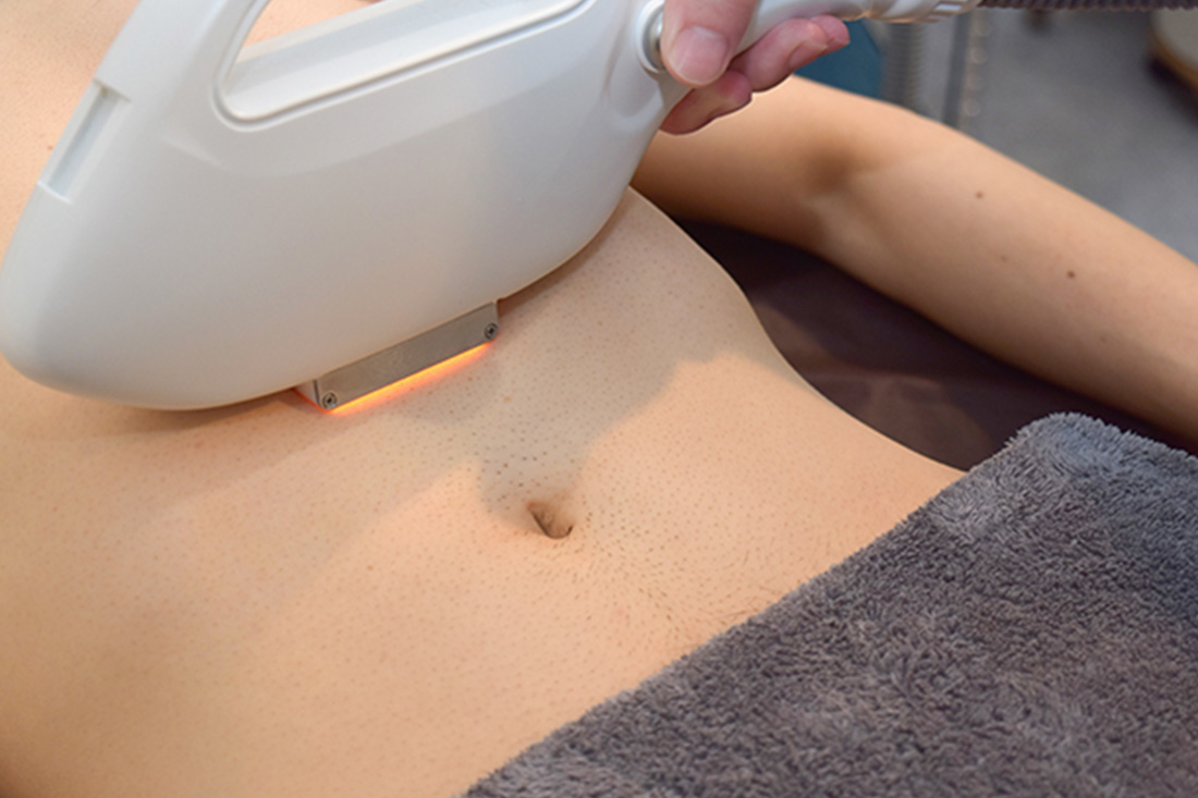 全身脱毛などニーズに合わせて選択可能